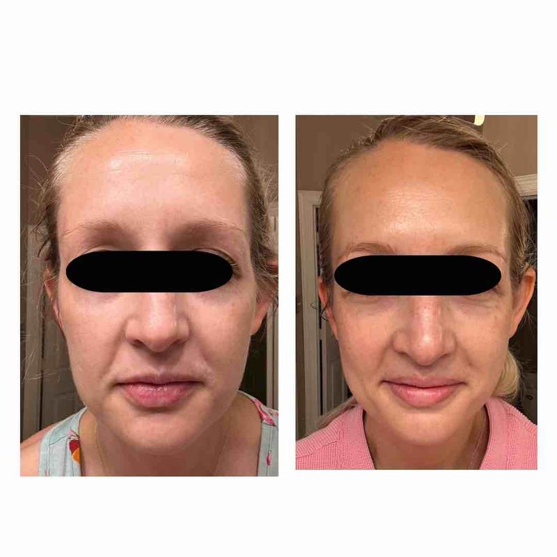 Review Thumbnail Image 0 233669188