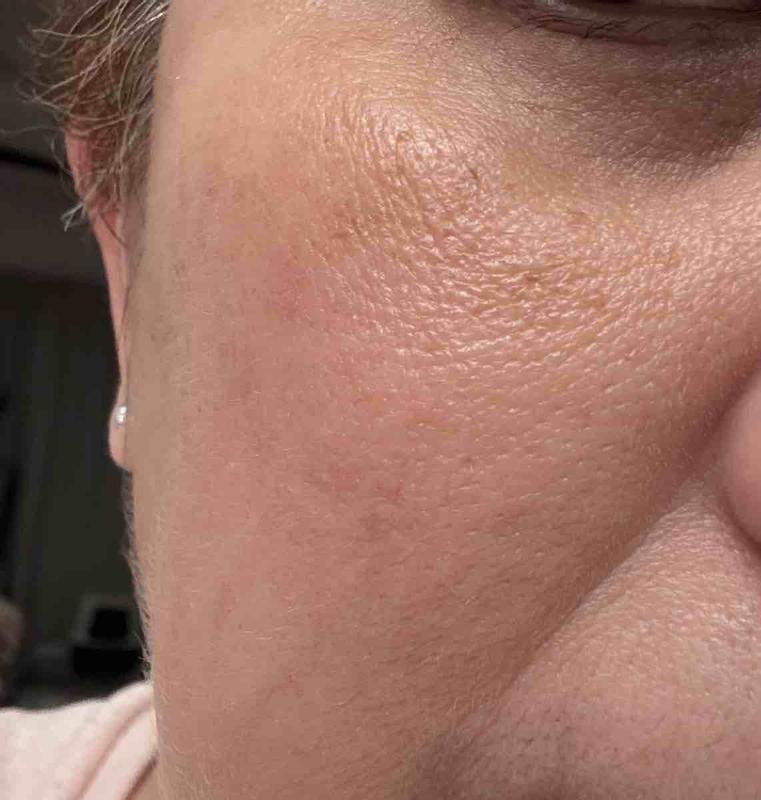 Review Thumbnail Image 1 247984137