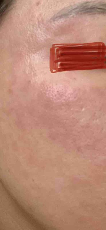 Review Thumbnail Image 0 218503466