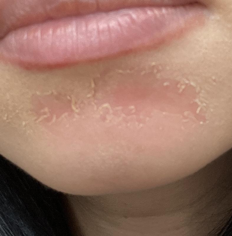 Review Thumbnail Image 0 237658878