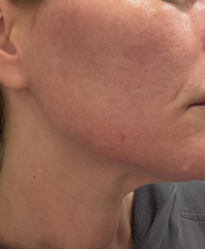 Review Thumbnail Image 1 249087282