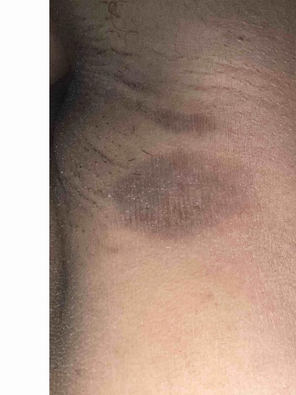 Customer photo for "smells great but causing irritation"
