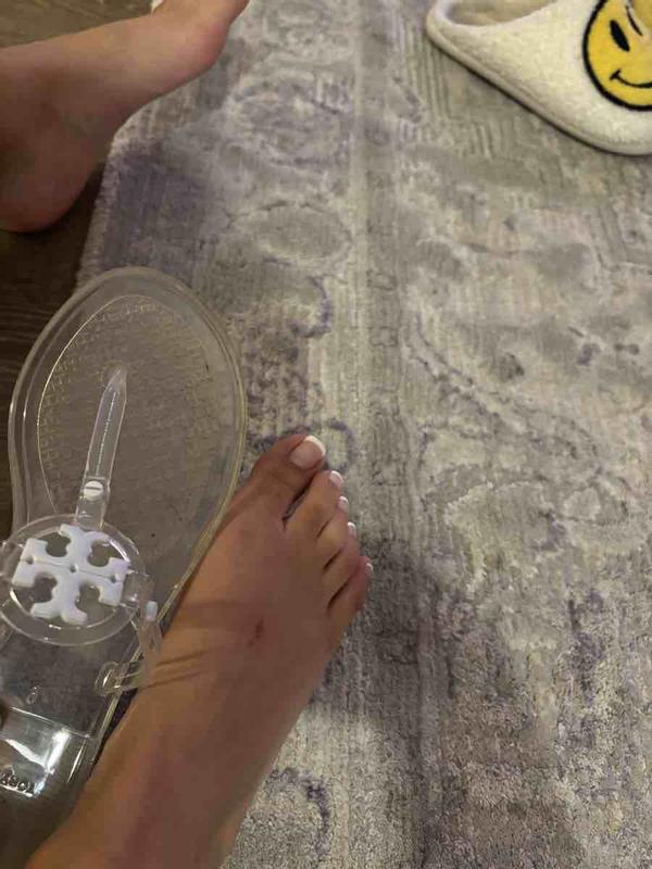 Customer photo for "Extremely uncomfortable, scarred my foot"