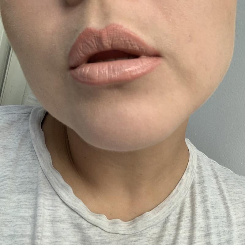 Review Thumbnail Image 1 238589036