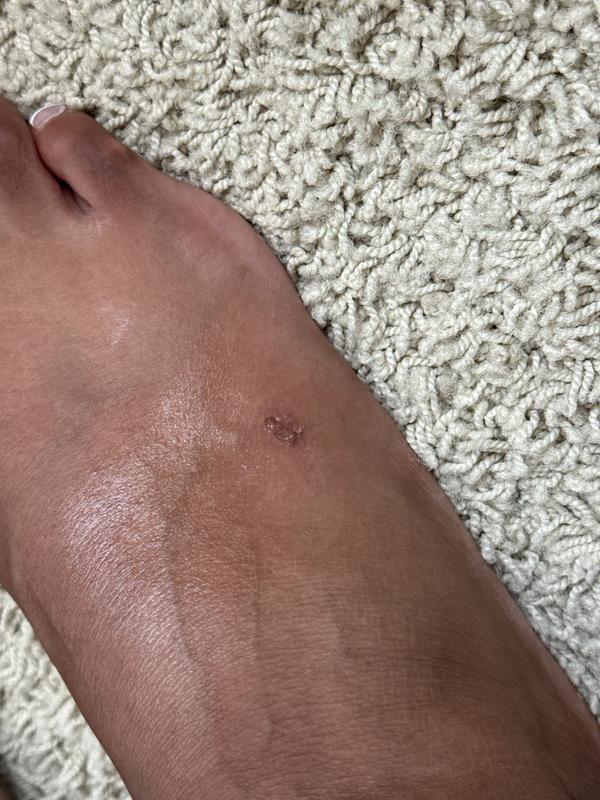 Customer photo for "The Hurt so bad!"