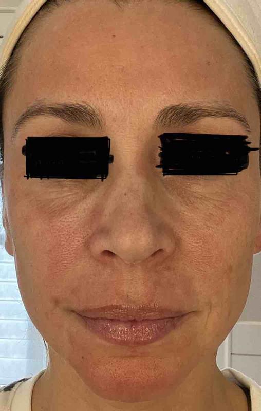 Too Strong for sensitive skin