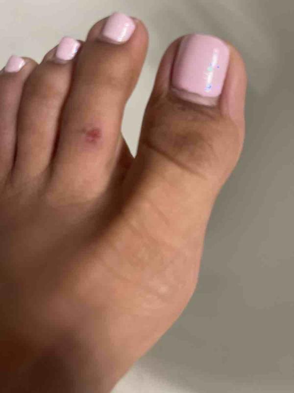 warning this sandals will cut your skin