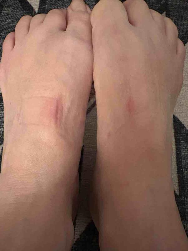 Customer photo for "Very Uncomfortable"