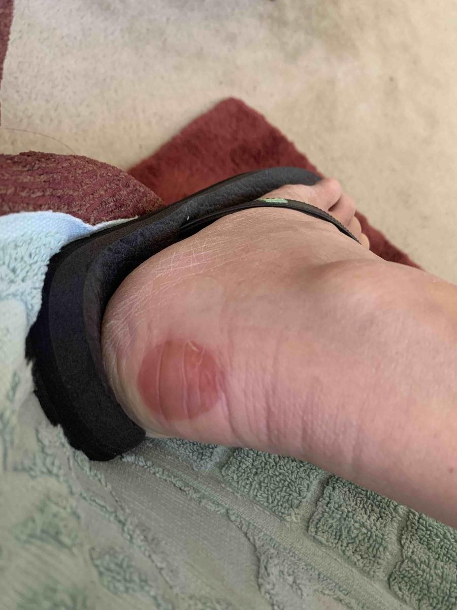 Customer photo for "wanted to love But no!"