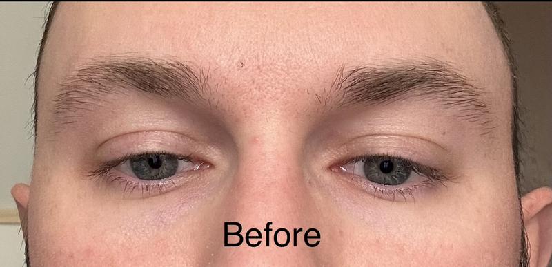 Customer photo for "AMAZING results!  But contains a prostaglandin…"