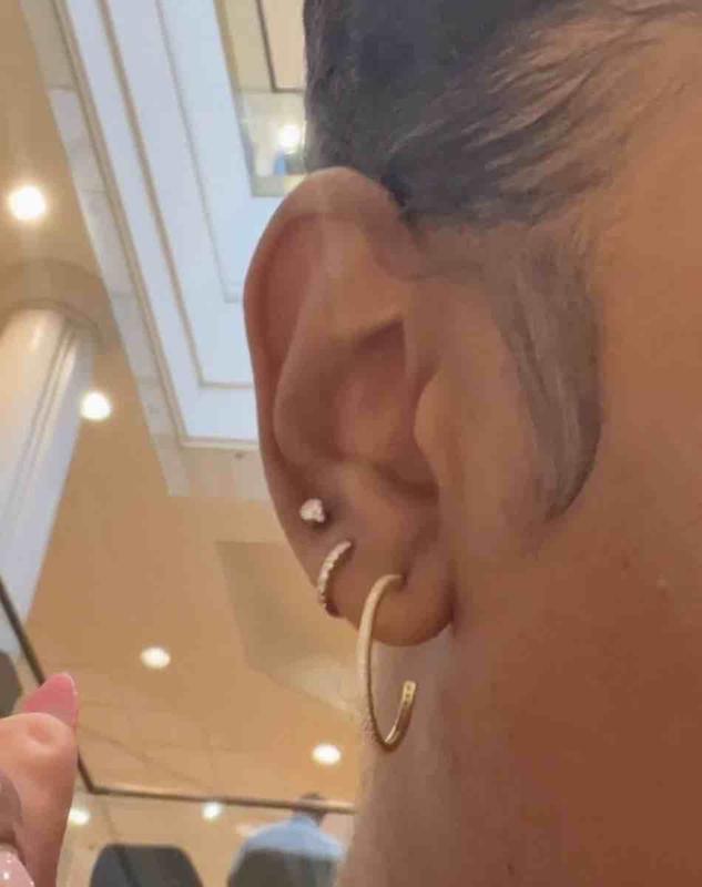 Customer review photo