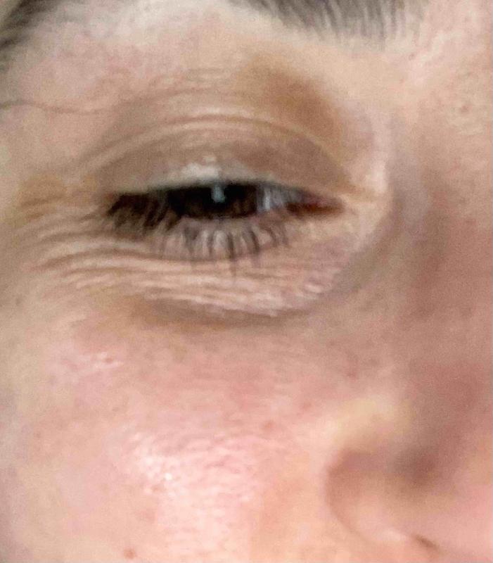 Review Thumbnail Image 0 211513100