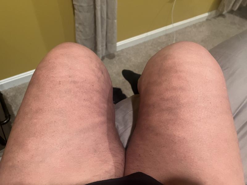 Review Thumbnail Image 2 229823799