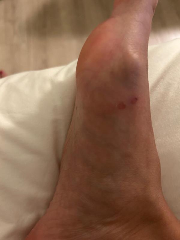 Review Thumbnail Image 0 240808334