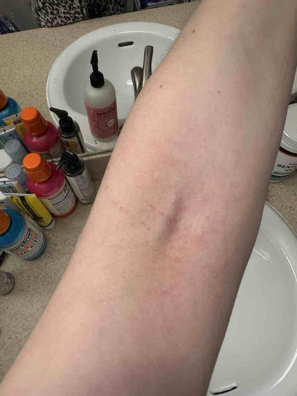 Review Thumbnail Image 0 241544207