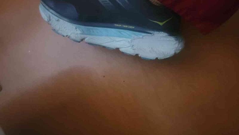 Got a defective product