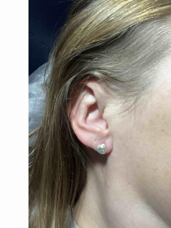 Review Thumbnail Image 0 226075988