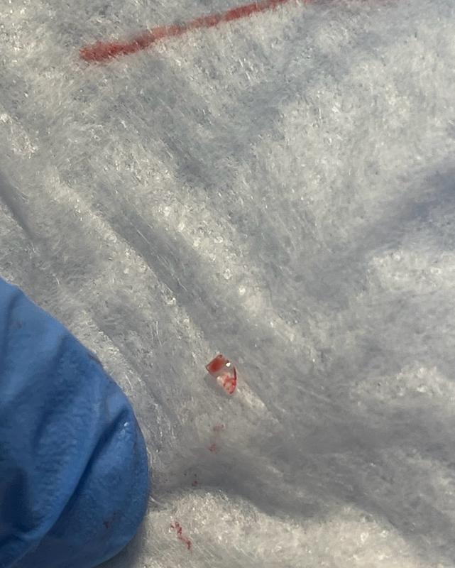 Review Thumbnail Image 0 233113146