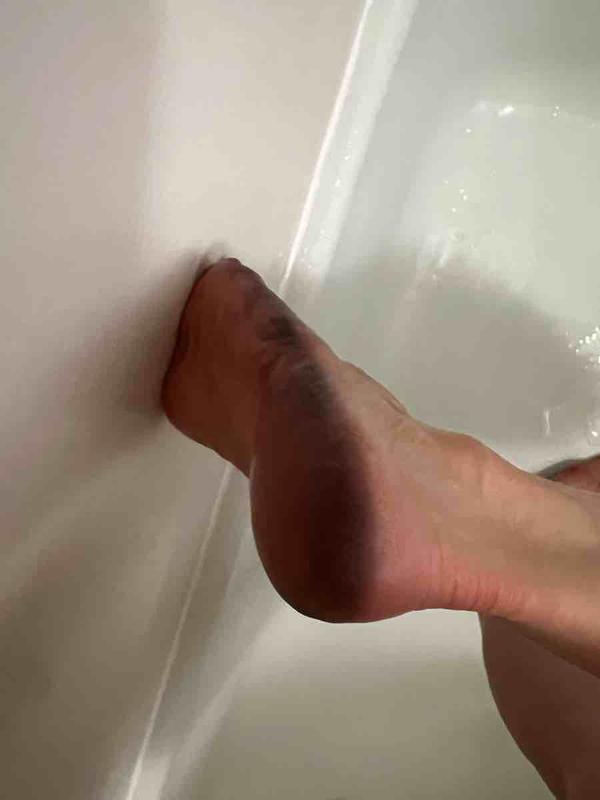 Committed fan but why the dye transfer!