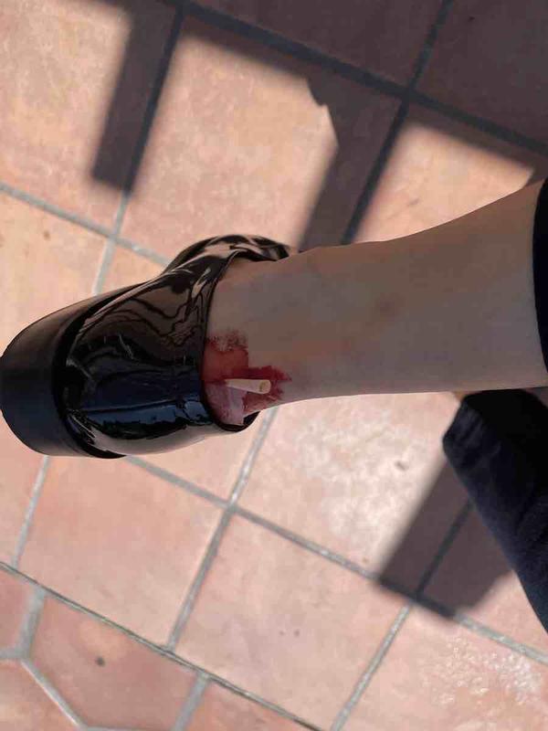 Customer photo for "ouch"