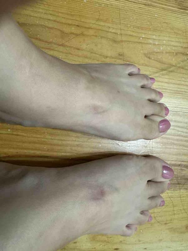 Customer photo for "not comfortable"