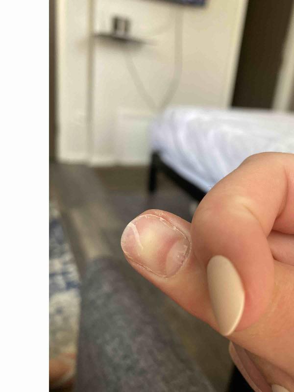 completely ruined my nails and not reusable