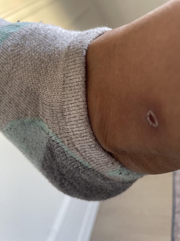 Hurt my leg above ankle