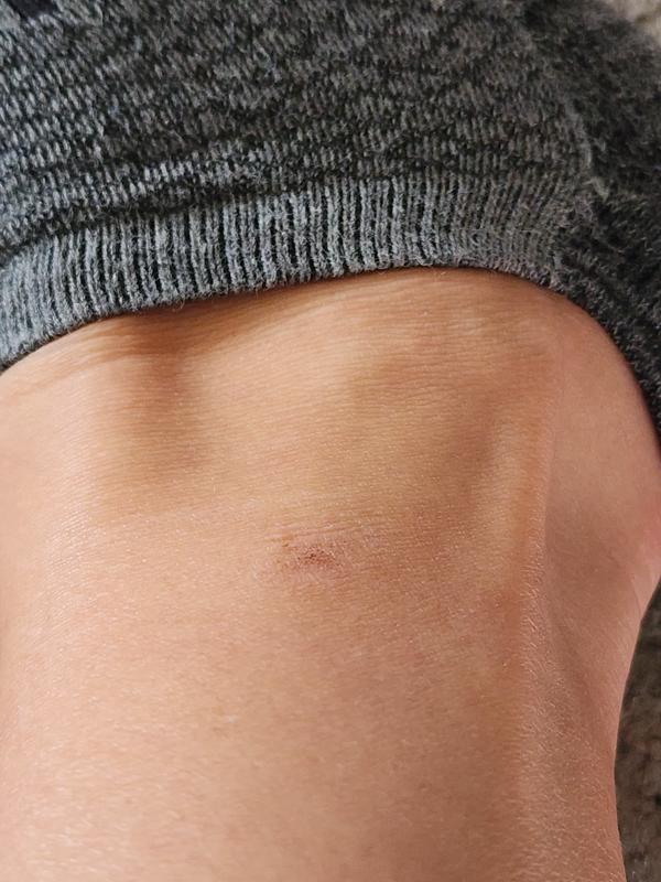 Customer photo for "Very uncomfortable"