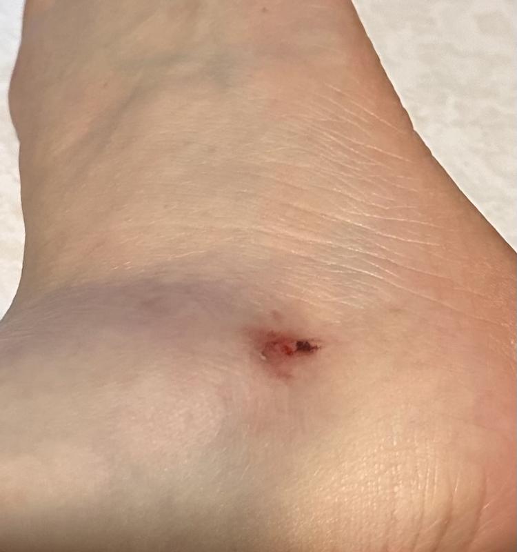 Review Thumbnail Image 1 248176272