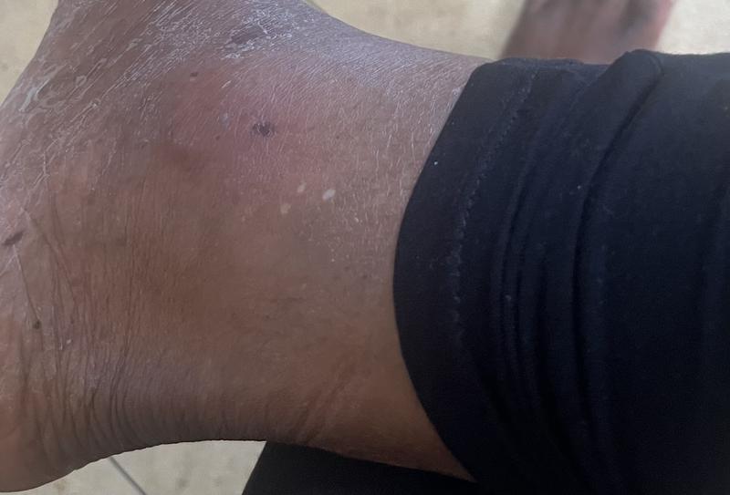 Review Thumbnail Image 0 236290971