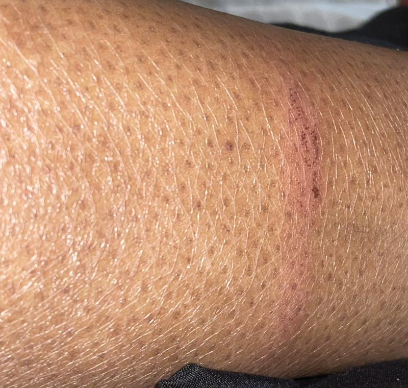 Review Thumbnail Image 1 224552856