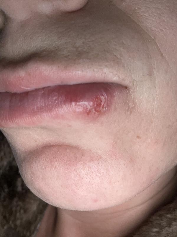 Review Thumbnail Image 0 237475719