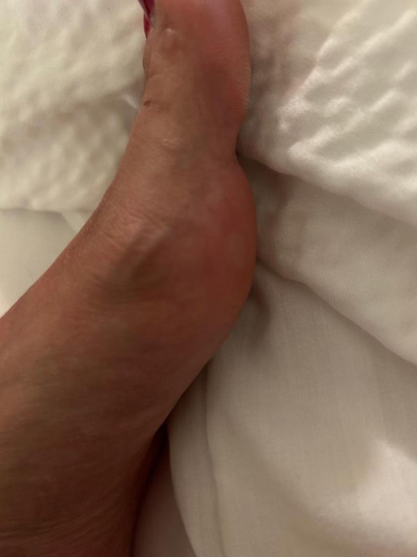 Review Thumbnail Image 1 240808334