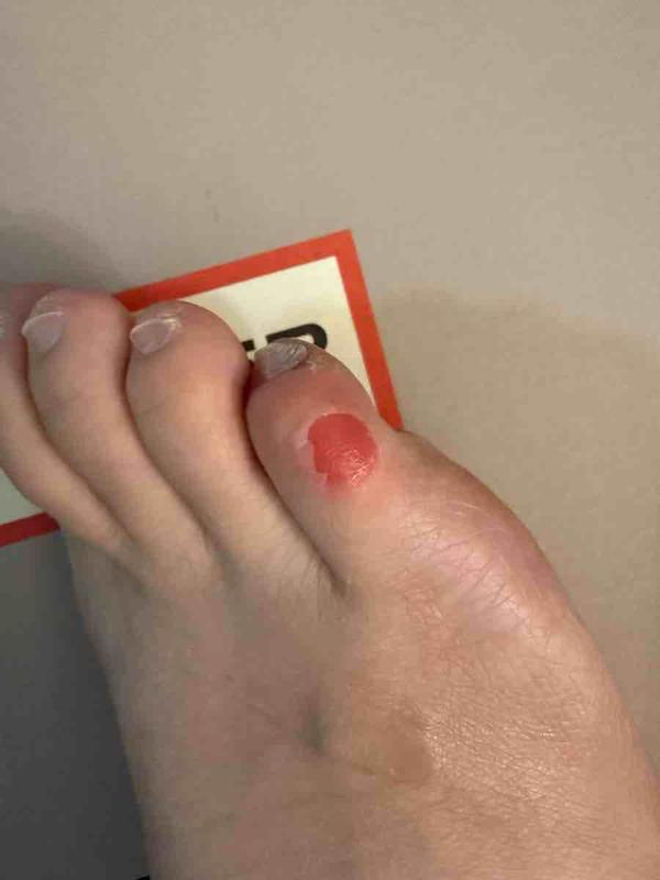 Review Thumbnail Image 1 for review 272618034
