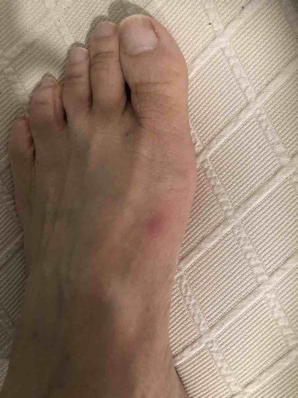 Review Thumbnail Image 0 242246054