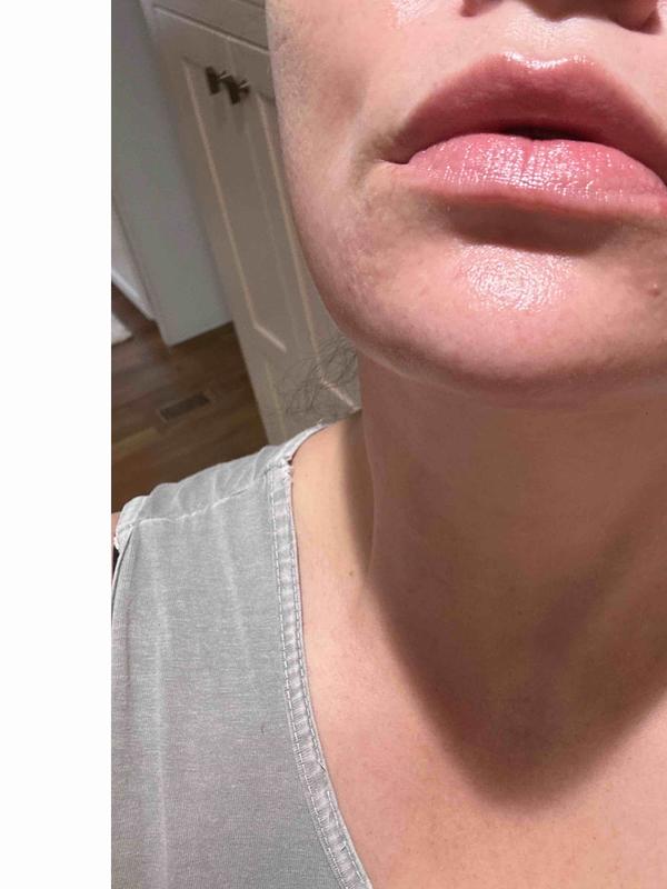 AMAZING ordering more!