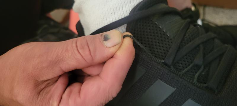 Customer photo for "Shoe Lace Loops are Terrible"