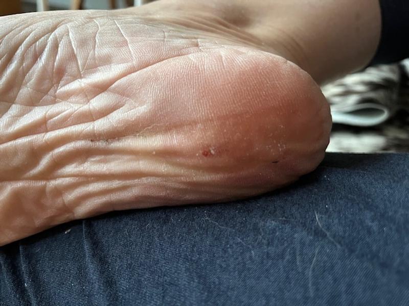 Review Thumbnail Image 1 242504498