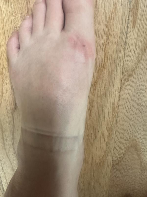 Cut on my foot from the shoes.