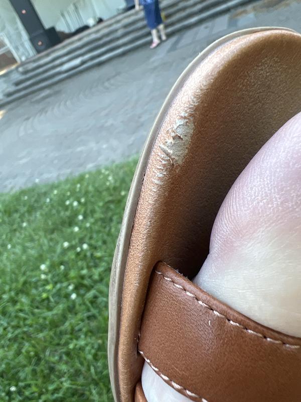 Peeling