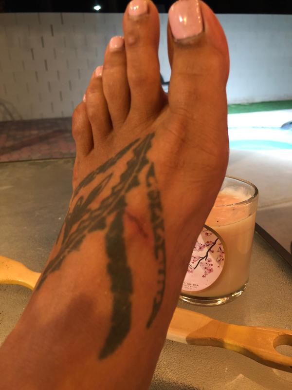 Rubs and Cut into the top of my foot