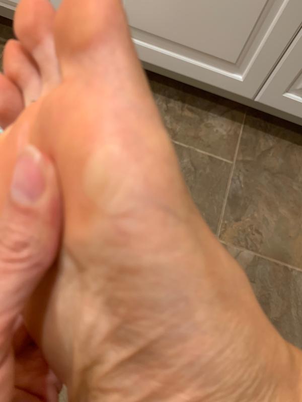 Foot Callus Remover | Dr. Scholl's