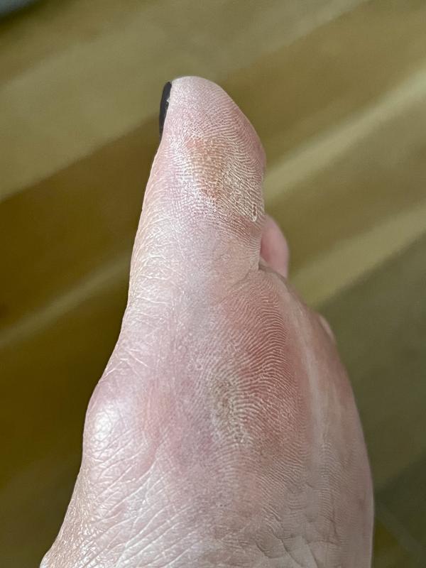 Dr. Scholl's® Hard Skin Remover Nano Glass Foot File ตะไบขัดเท้า  ที่ขัดส้นเท้า ขจัดแคลลัส สปาเท้า ส้นเท้าแตก Foot Scrubber, Foot Callus  Remover