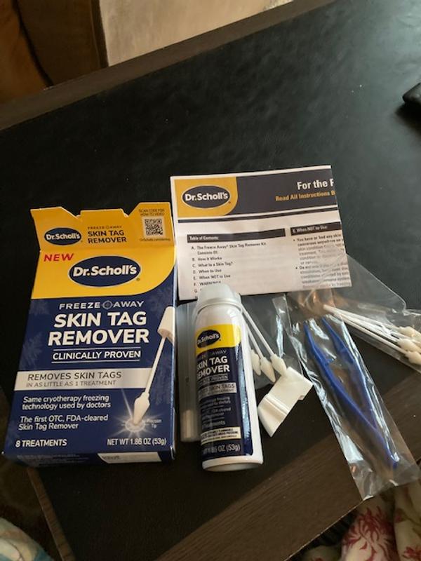Removing Skin Tags with Dr Scholl's Skin Tag Remover
