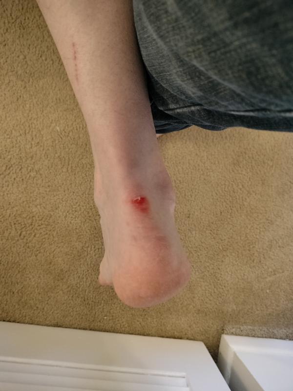 Photo submitted with review of product