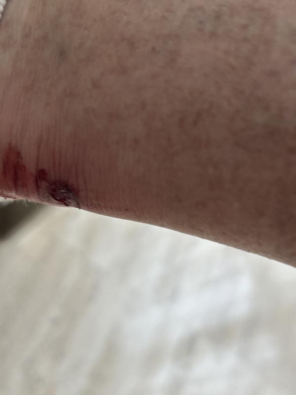 Customer photo for "Garbage. Unsafe & injury prone"
