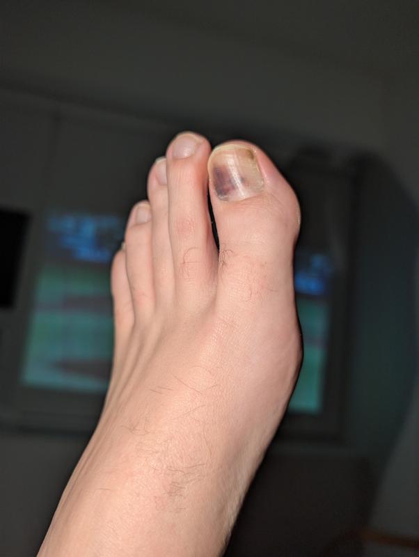 Customer photo for "Size Issue"