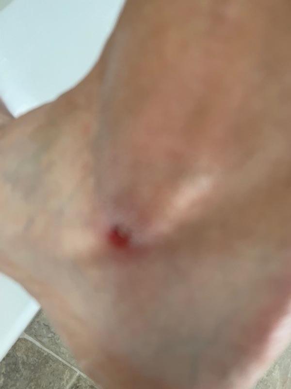Photo submitted with review of product