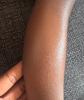 Moisturised skin after application.
