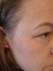 Reduced dark spots
